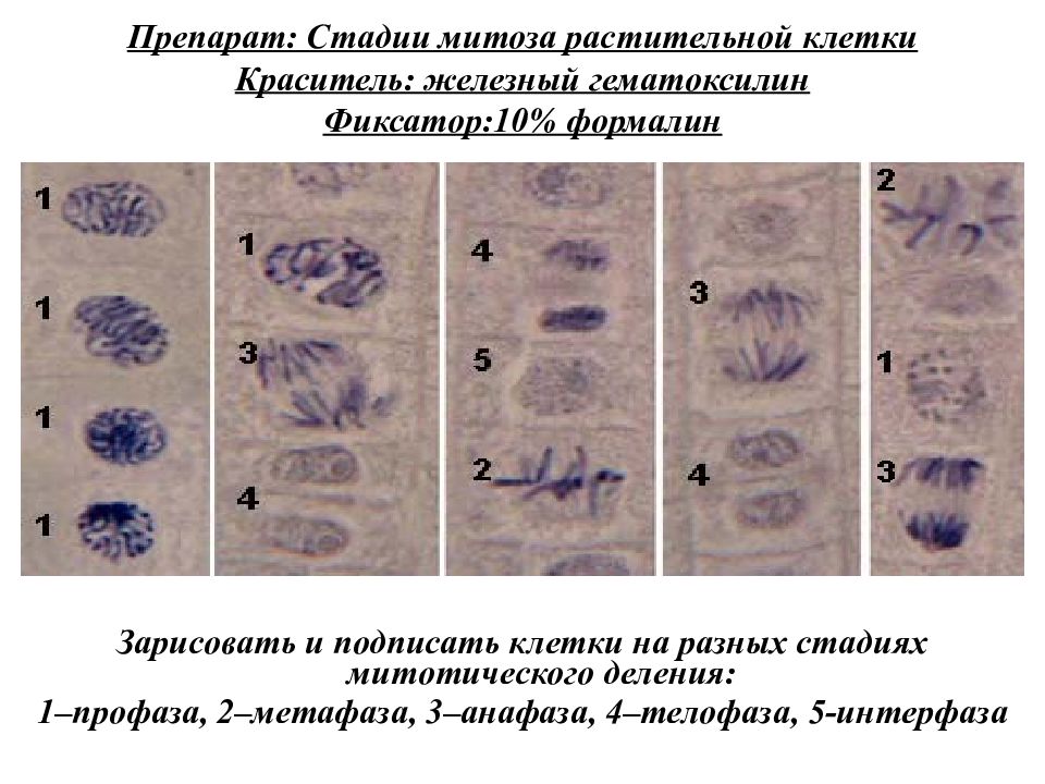 Изучение фаз митоза на фиксированном препарате метод. Железный гематоксилин препарат митоз. Митотическое деление растительной клетки гистология. Телофаза митоза гистология.