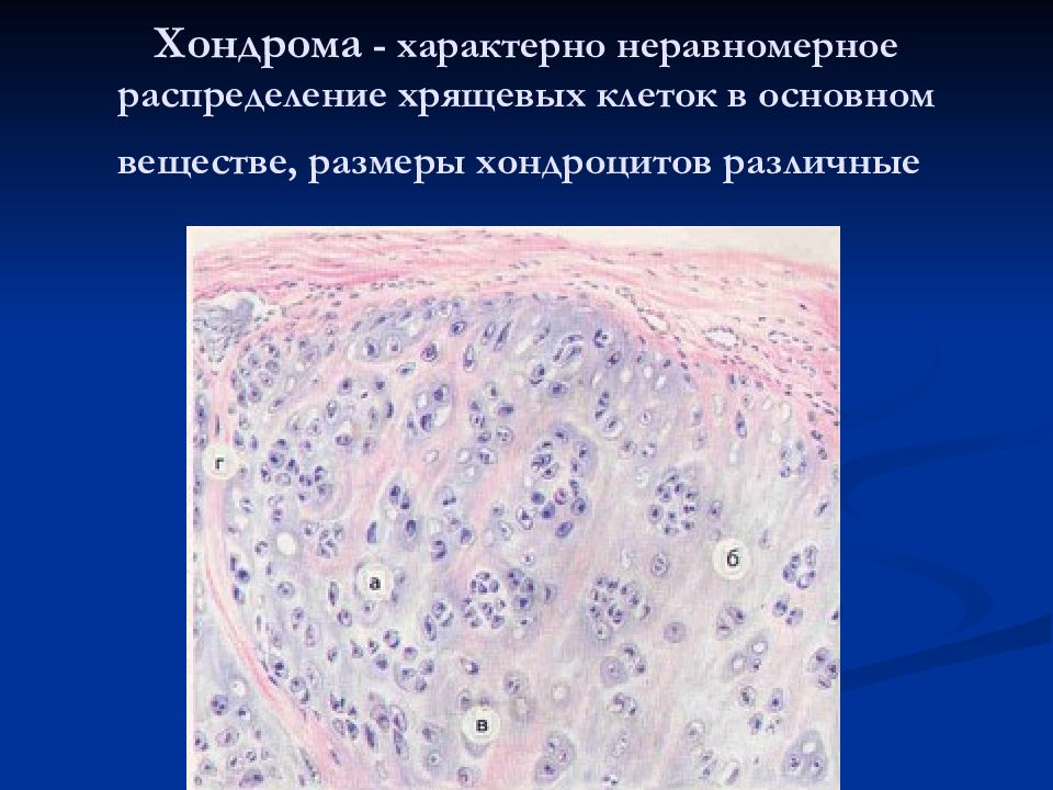 Мезенхимальные опухоли патанатомия презентация