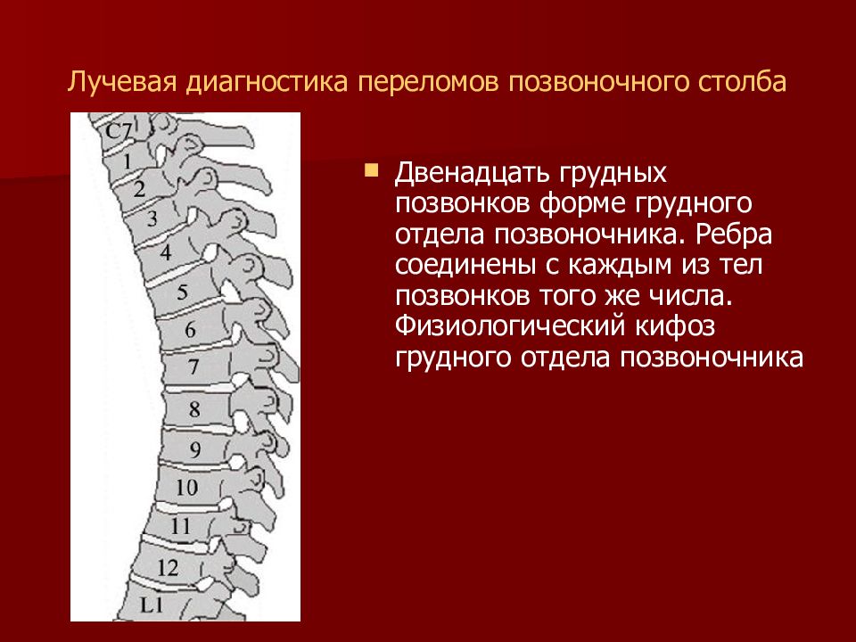 Диагностика переломов. Измерение угла кифоза грудного отдела. Рентгенодиагностика кифоза грудного отдела. Угол кифоза грудного отдела позвоночника.