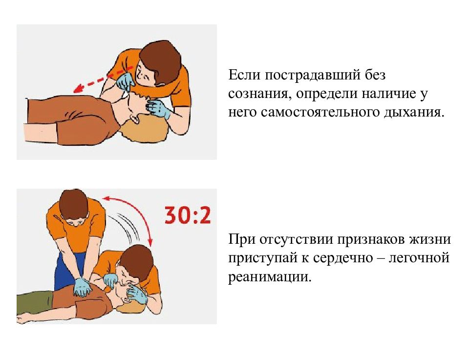 Оказание первой помощи при отсутствии сознания презентация