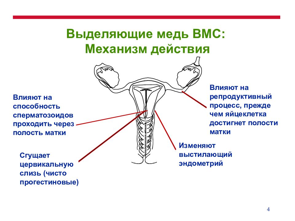 Спираль от беременности минусы. Спираль внутриматочная. Гинекологическое спираль внутриматочная. Механизм действия ВМС спирали. Спираль противозачаточная круглая.