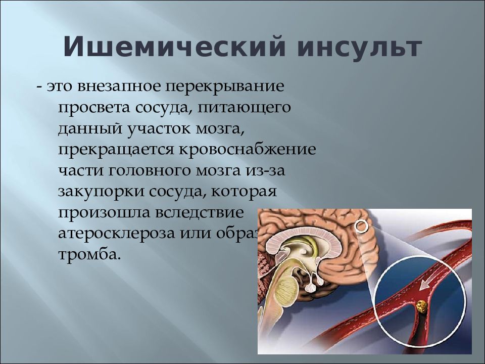 Ишемический инсульт последствия. ОНМК ишемический инсульт. Осложнения ОНМК ишемический инсульт. Тромб при ишемическом инсульте.