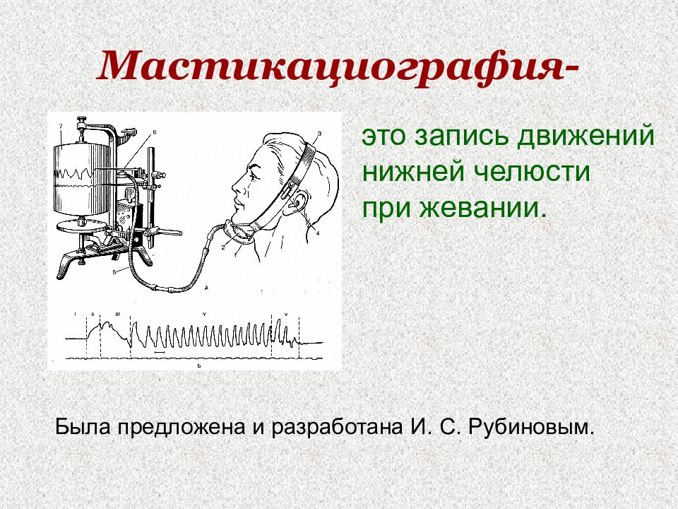 Запись движения. Мастикациография фазы. Мастикациография физиология. Мастикациография в стоматологии. Методика проведения мастикациографии..