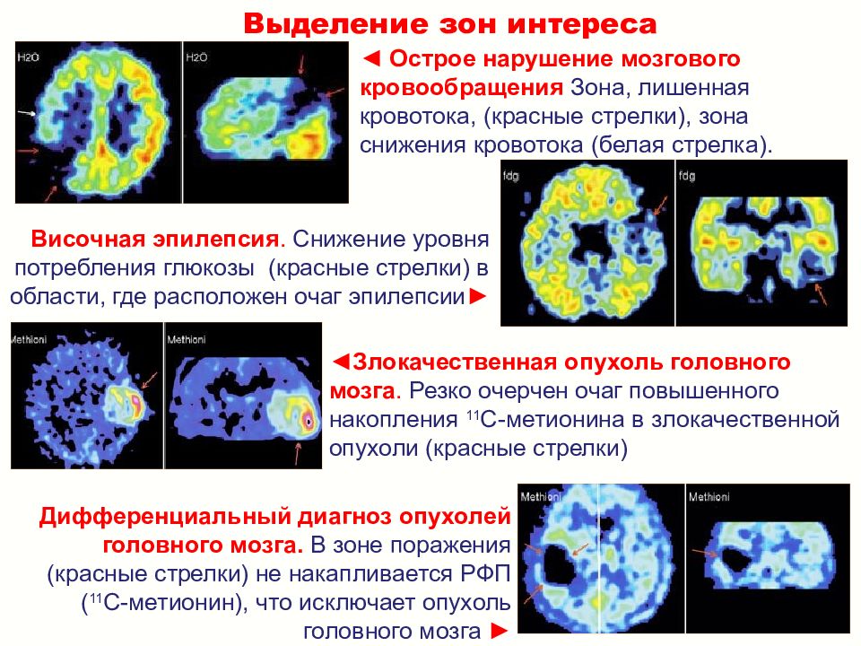 Презентация на тему ядерная медицина