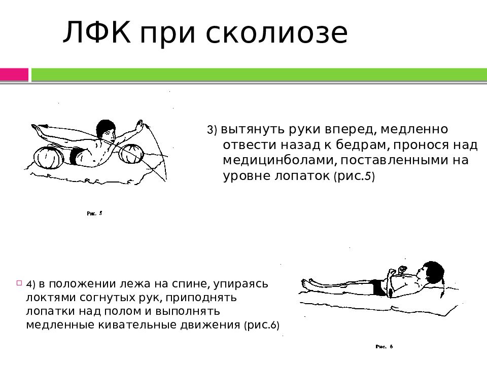 Презентация лфк при сколиозе