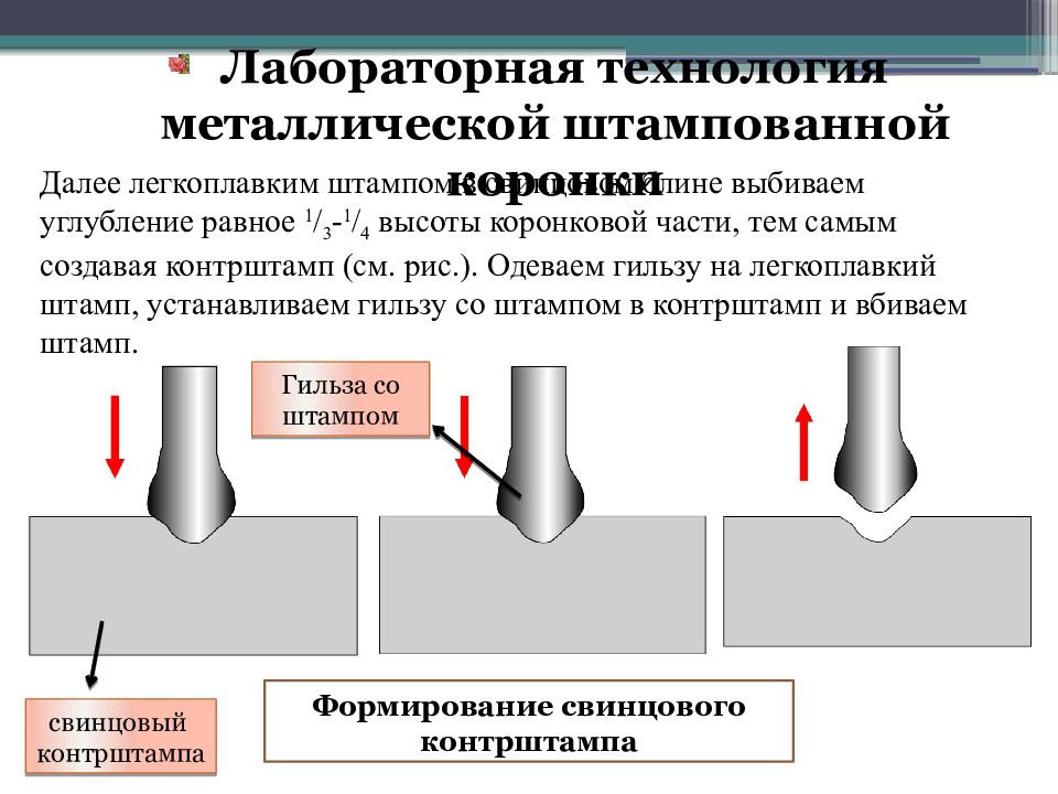 Процесс изготовления коронок. Процесс изготовления штампованной коронки. Предварительная штамповка металлической коронки. Технология предварительной штамповки коронок. Наружный метод штамповки металлических коронок.