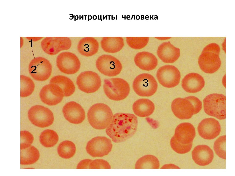 Эритроцит лягушки рисунок. Эритроциты человека. Эритроциты крови человека. Зарисуйте эритроцит. Клетка эритроцита человека.