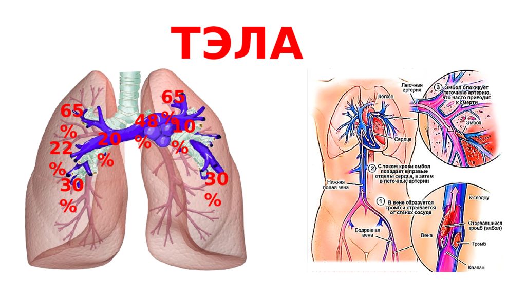 Тэла презентация хирургия