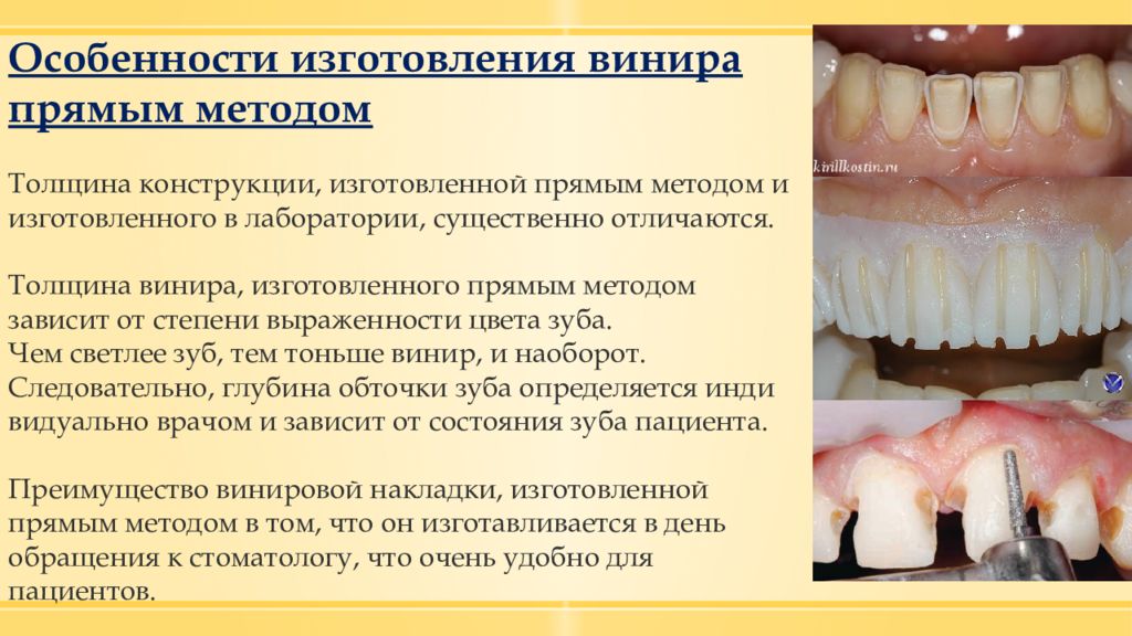 Клинико лабораторные этапы вкладок