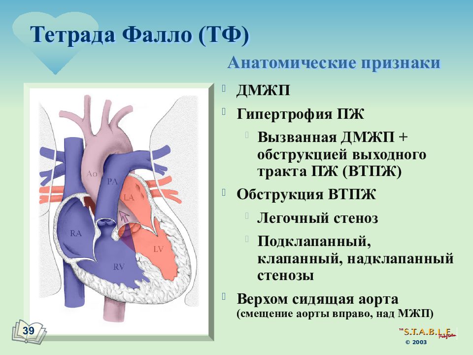 Тетрада фалло презентация