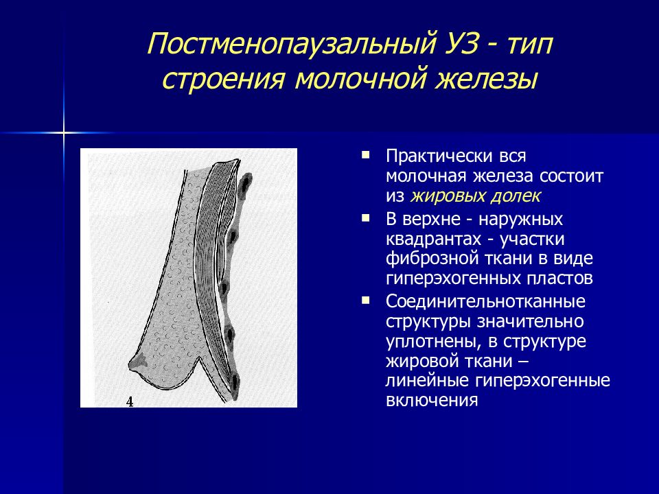 Железистый тип строения молочных желез