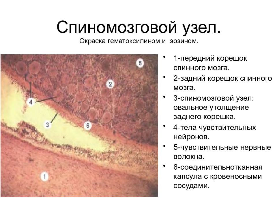 Спинномозговой узел гистология рисунок