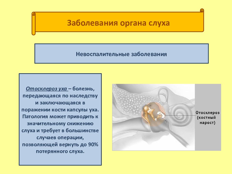 Болезни слуха презентация