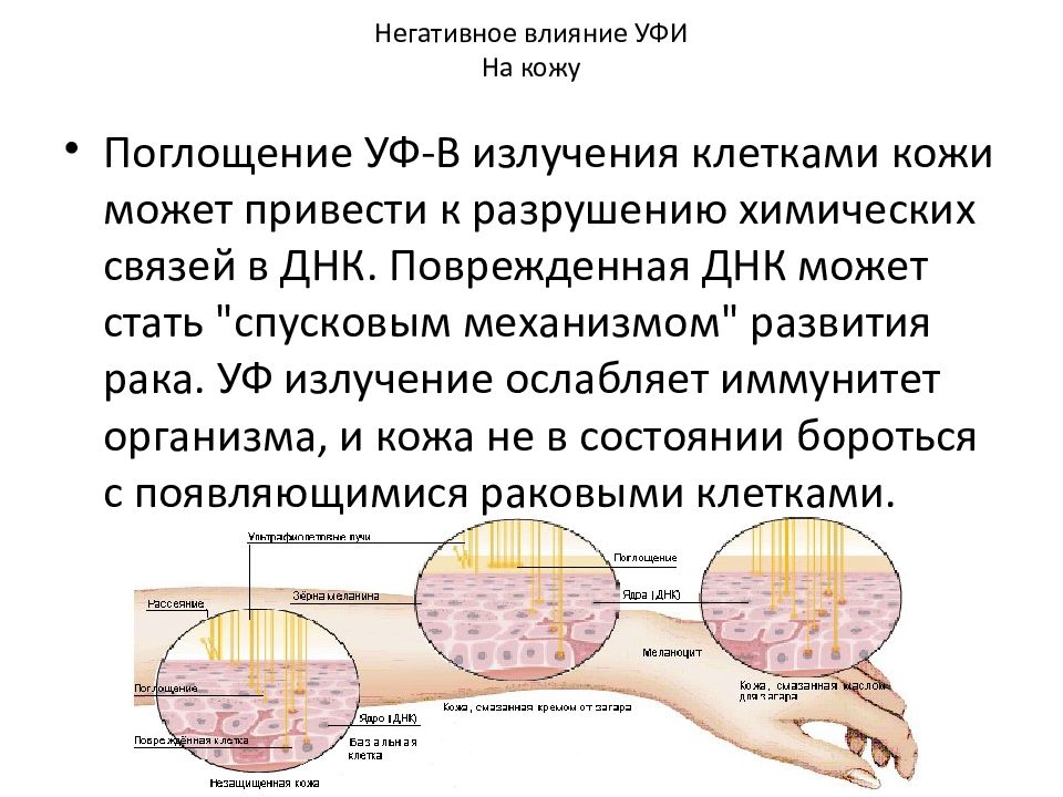 Под действием ультрафиолетовых лучей в коже образуется. Влияние ультрафиолетового излучения на клетку. Ультрафиолетовое излучение влияние на ДНК. Влияние УФ лучей. Воздействие ультрафиолетовых лучей на клетки кожи