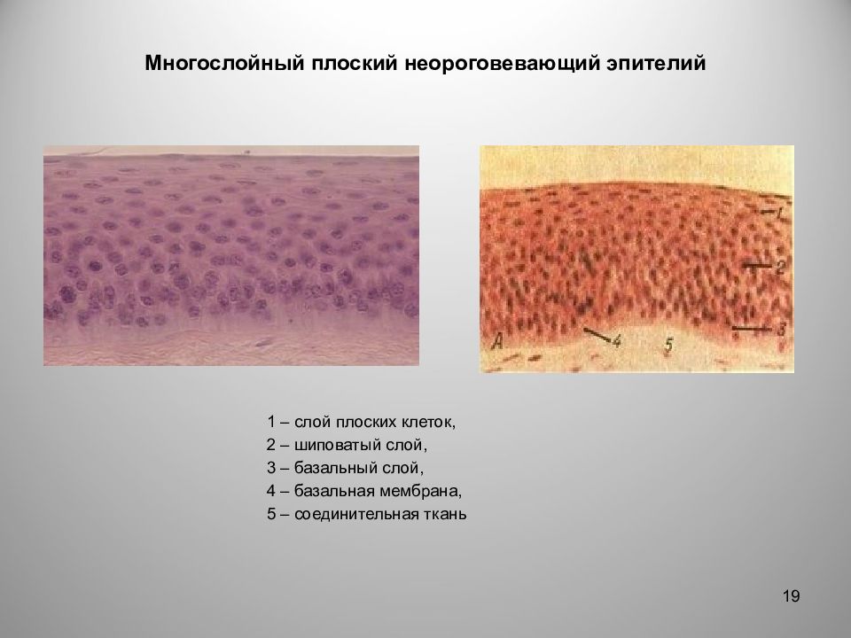 Многослойный неороговевающий эпителий рисунок