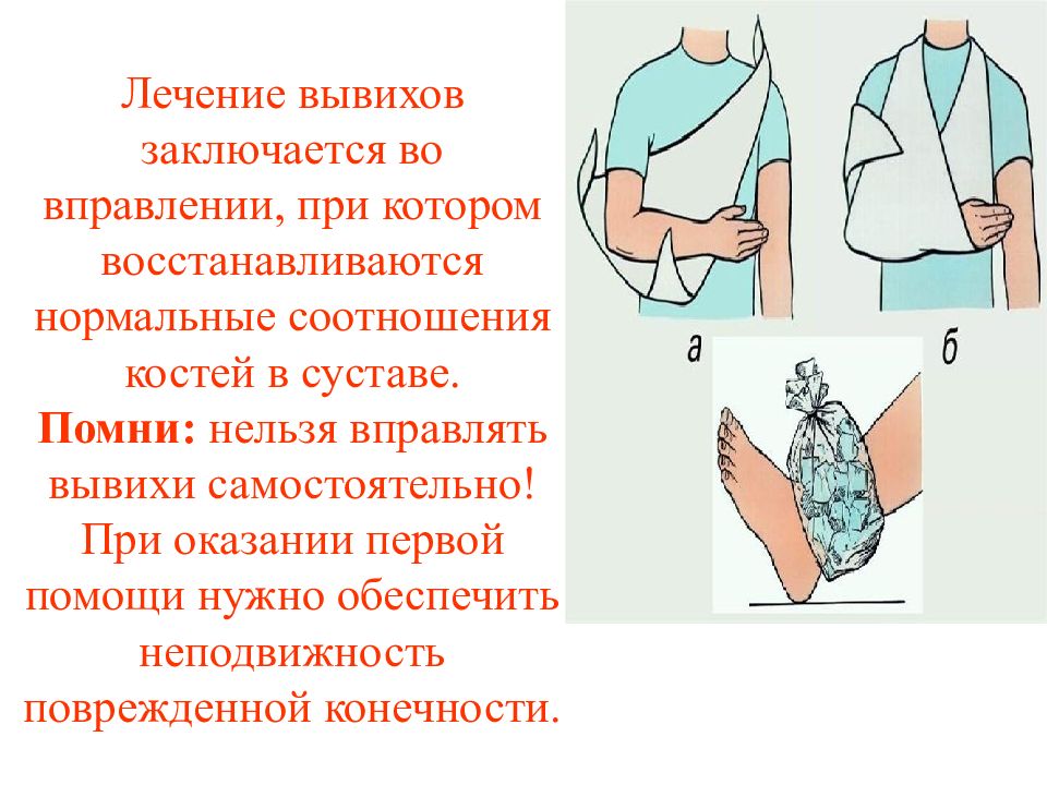 Первая помощь при вывихе сустава. Принципы лечения вывихов. Почему вывих нельзя вправлять. Лечение вывиха.