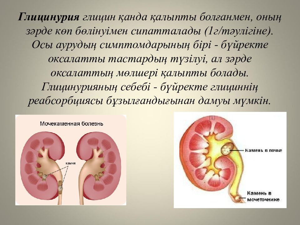 Жеке аминқышқылдардың алмасуы және оның бұзылуының биохимиялық негіздері Жеке аминқышқылдардың алмасуы және оның бұзылуының биохимиялық негіздері