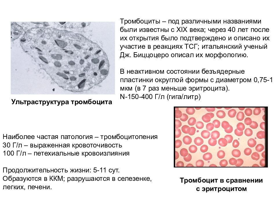 Повышенное распределение тромбоцитов