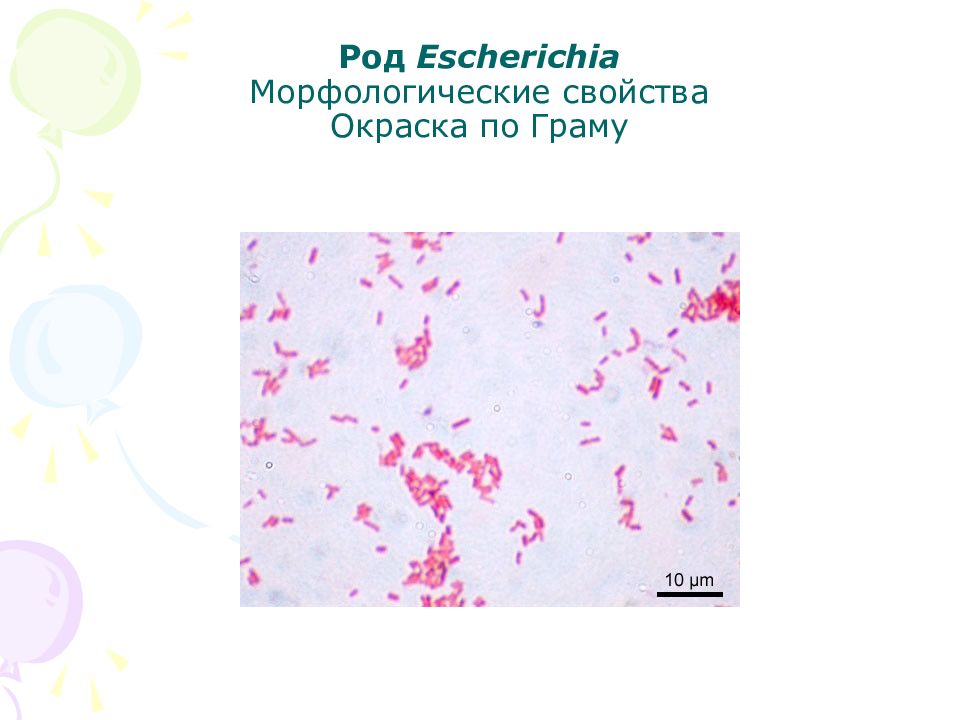 Презентация энтеробактерии микробиология