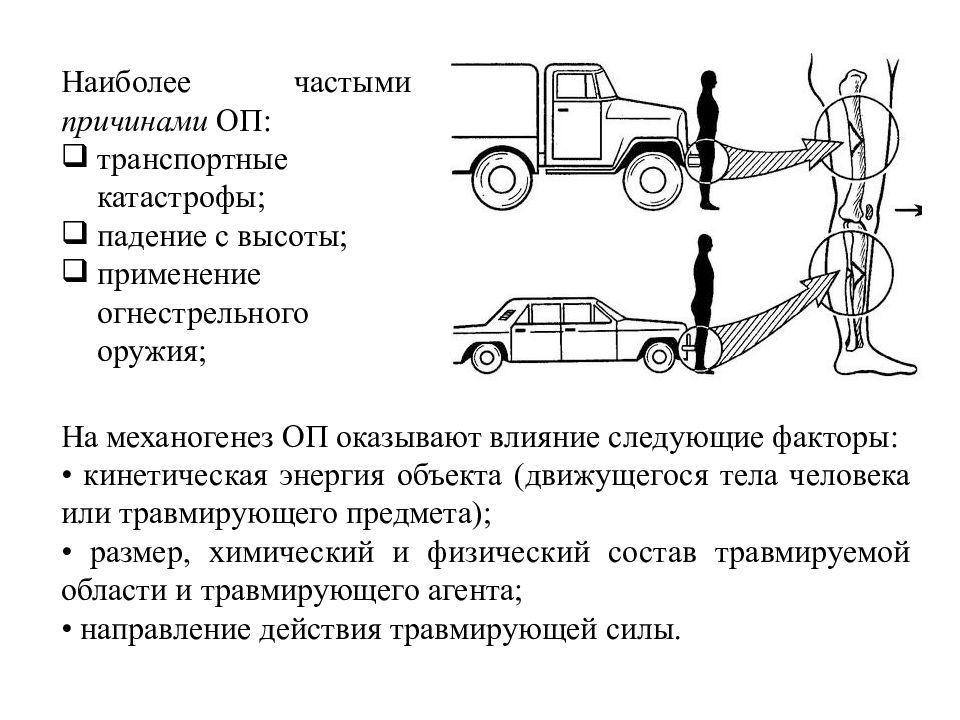 Оп это. Направление действия травмирующей силы. Каково направление действия травмирующей силы.