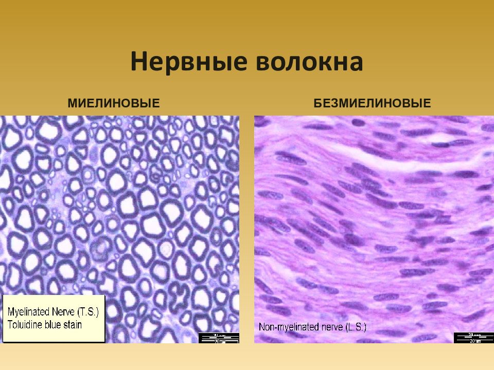 Безмиелиновые нервные волокна гистология рисунок