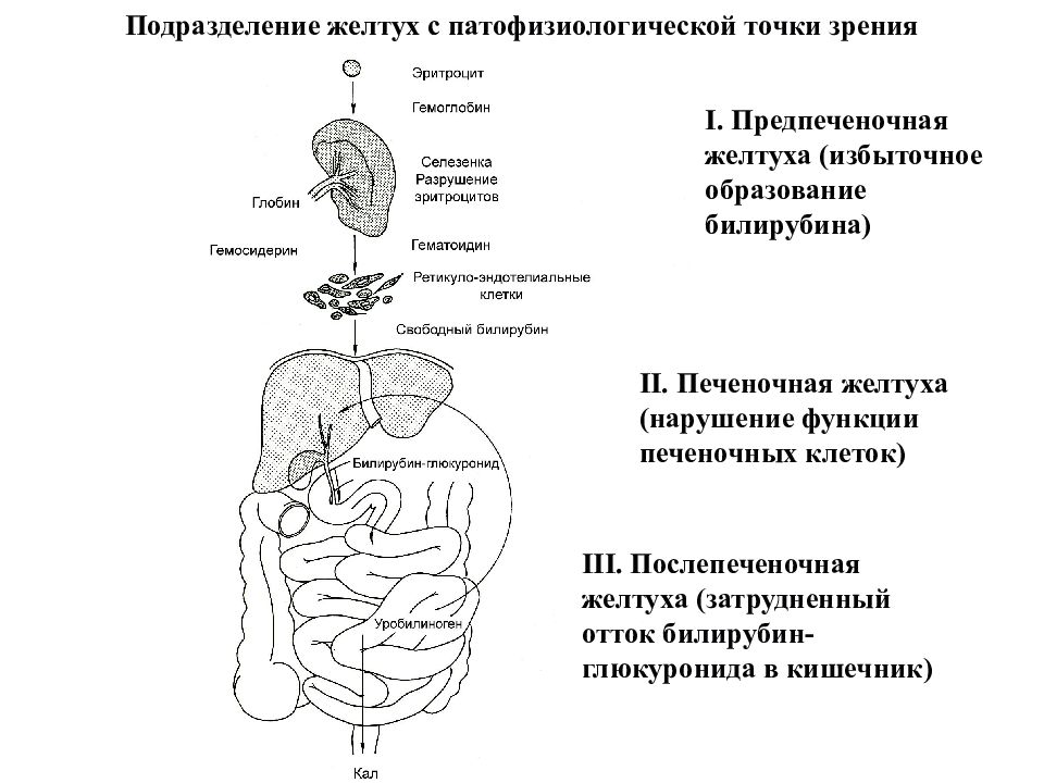 Печеночная желтуха