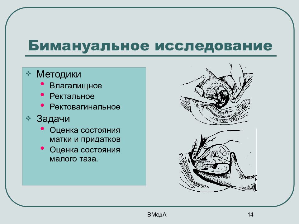 Влагалищное исследование. Бимануальное влагалищное исследование алгоритм. Бимануальные исследования в гинекологии. Бимануальное исследование шейки матки. Бимануальное исследование в гинекологии техника.