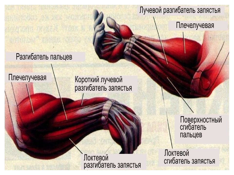 Болят мышцы руки лечение. Мышцы руки. Болят мышцы предплечья. Болит мышца предплечья левой руки. Болит мышца предплечья правой руки.