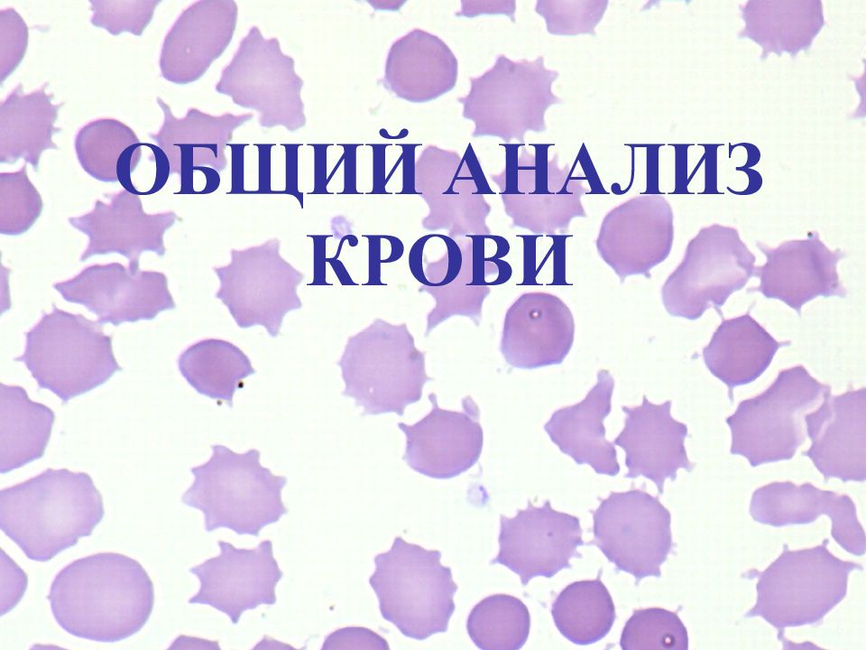 ОБЩИЙ АНАЛИЗ КРОВИ