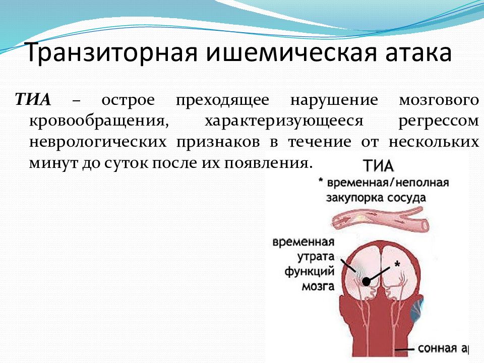 Транзиторная ишемическая атака карта вызова скорой медицинской