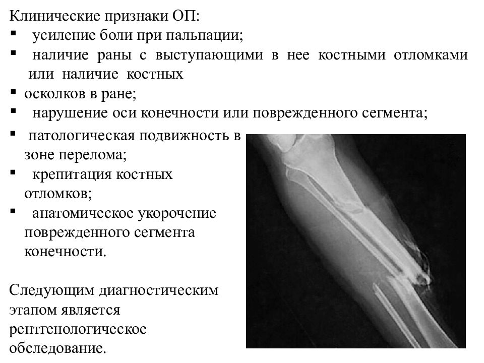 Симптомы открытого перелома. Критерии открытого перелома. Противопоказания перелома. Характеристика открытого перелома.