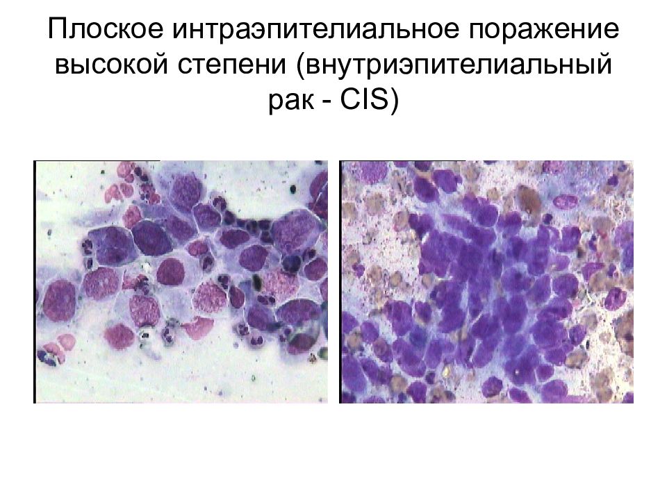 Цитологическая диагностика заболеваний шейки матки презентация