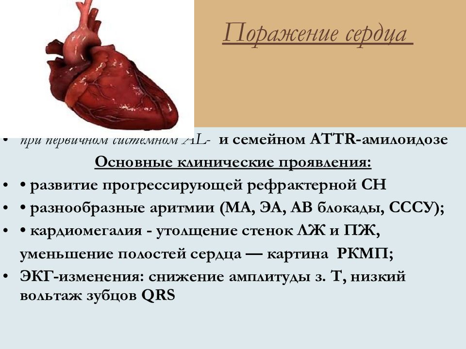 Поражение сердца. Амилоидоз сердца презентация.