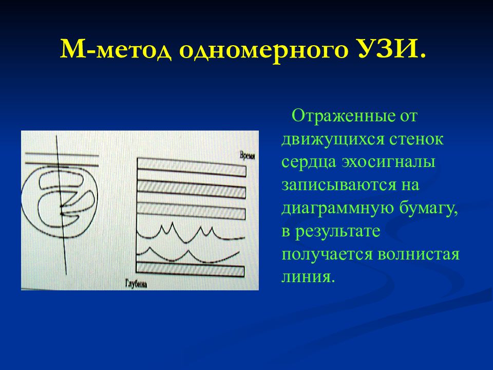 Способ м. Одномомерный ультразвуковой метод исследования. Одномерный метод УЗИ. Одномерные методы УЗИ. Одномерный метод ультразвукового исследования.