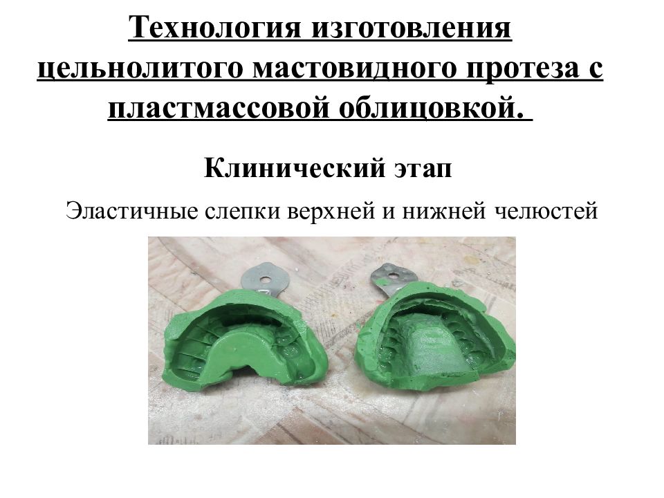 Изготовление цельнолитых протезов. Цельнолитые мостовидные протезы с пластмассовой облицовкой. Цельнолитая с пластмассовой облицовкой. Коронки с облицовкой из пластмассы. Цельнолитой протез с пластмассовой облицовкой.