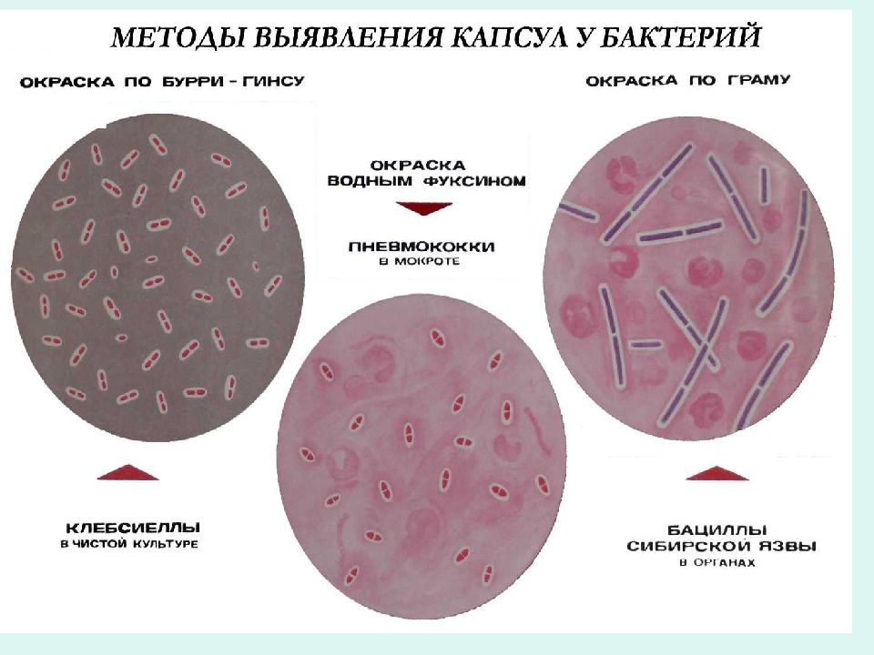 Метод бурри гинса. Метод по Бурри ГИНСУ микробиология. Капсула бактерий окраска по Бурри-ГИНСУ. Окраска капсульных бактерий по методу Бурри-Гинса. Мазок по Бурри ГИНСУ S pneumoniae штамм 2.