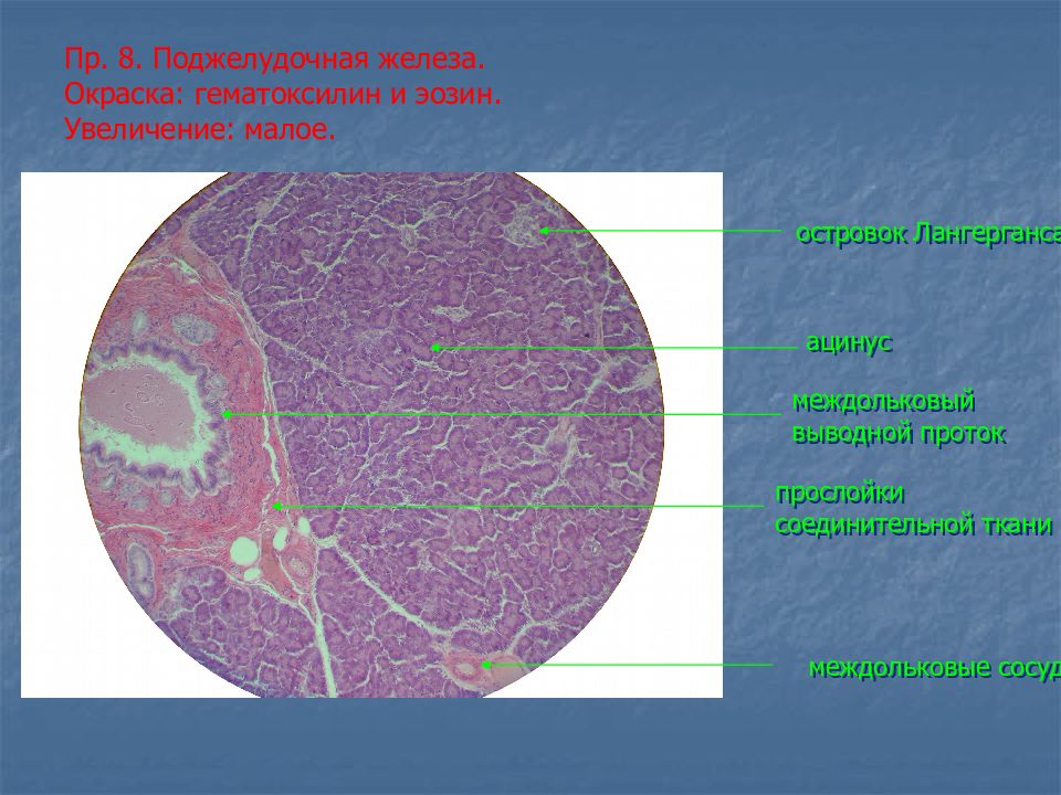 Увеличенная малая. Окраска гематоксилин-эозином в гистологии. Островки Лангерганса гематоксилин эозин. Поджелудочная железа гистология гематоксилин эозин. Поджелудочная железа препарат гематоксилин эозин.