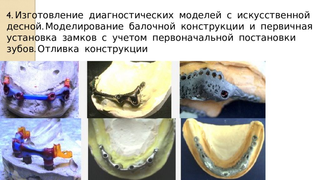 Объемное моделирование протеза презентация