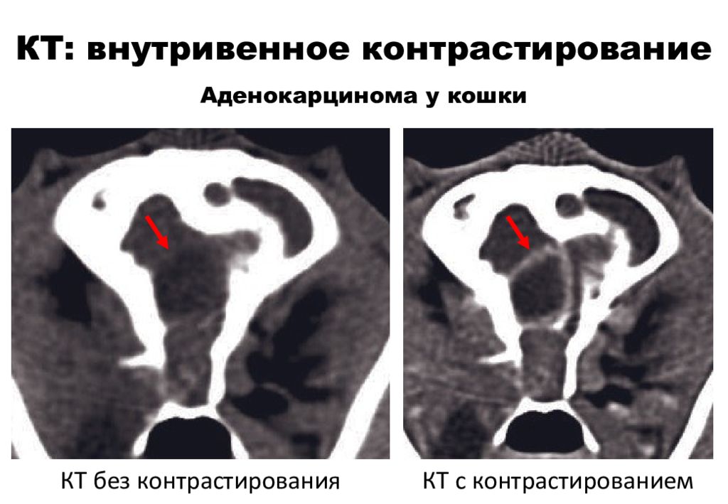 Кт грудной полости с внутривенным болюсным контрастированием. Поздняя артериальная фаза контрастирования на кт. Новообразование гипофиза у крысы. Карциноид поджелудочной железы кт. Кт с внутривенным болюсным контрастированием.