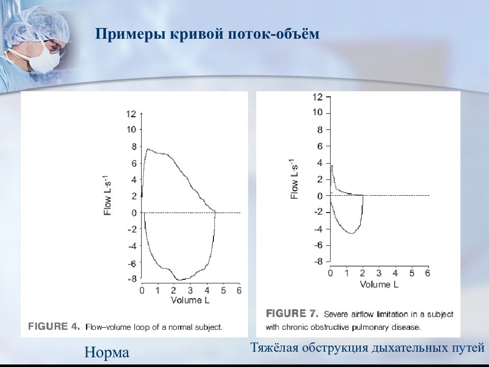 Объемная скорость выдоха. Кривая поток объем. Кривая поток объем на спирометрии. Кривая объем поток в физиологии. Петля поток объем.