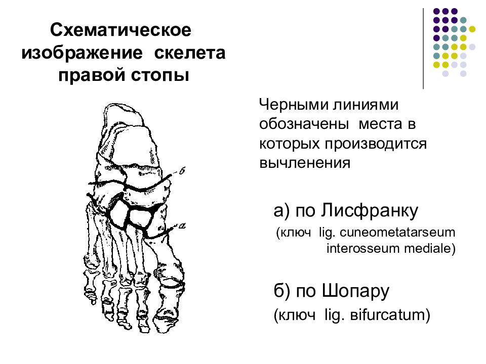 Ампутация по шопару схема