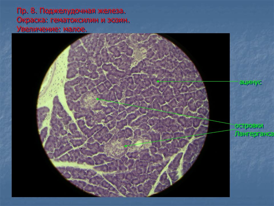 Увеличенная малая. Поджелудочная железа окраска гематоксилин-эозином. Поджелудочная железа гематоксилин эозин Малое увеличение. Ацинус легкого. Окраска гематоксилином и эозином. Малое увеличение.. 35. Поджелудочная железа (гематоксилин-эозин).