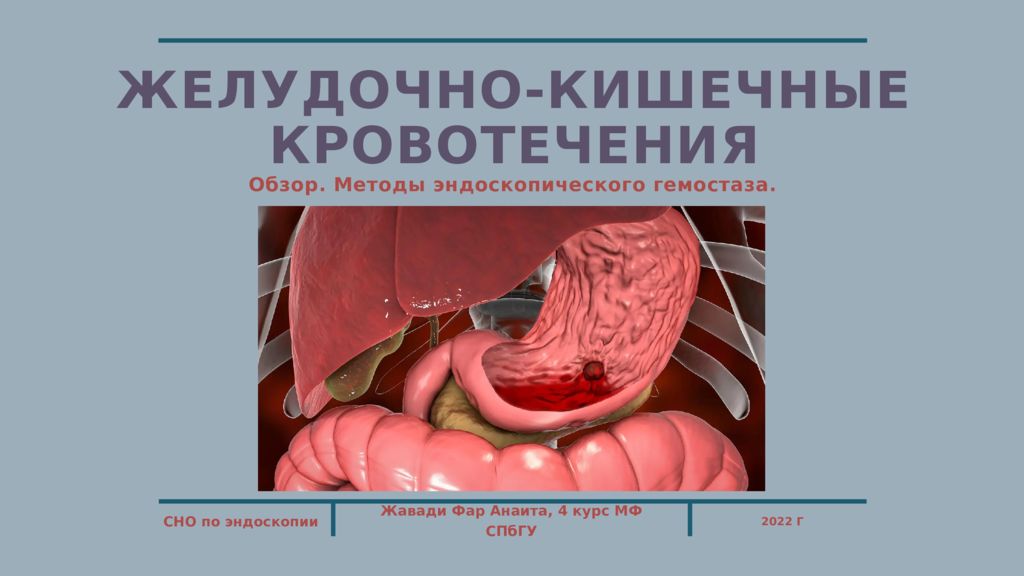 жЕЛУДОЧНО -КИШЕЧНЫЕ КРОВОТЕЧЕНИЯ
