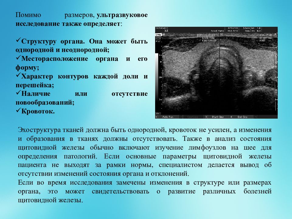 Размер органа. Аутоиммунный тиреоидит протокол УЗИ. Аутоиммунный тиреоидит по УЗИ. Протокол УЗИ щитовидной железы аутоиммунный тиреоидит.