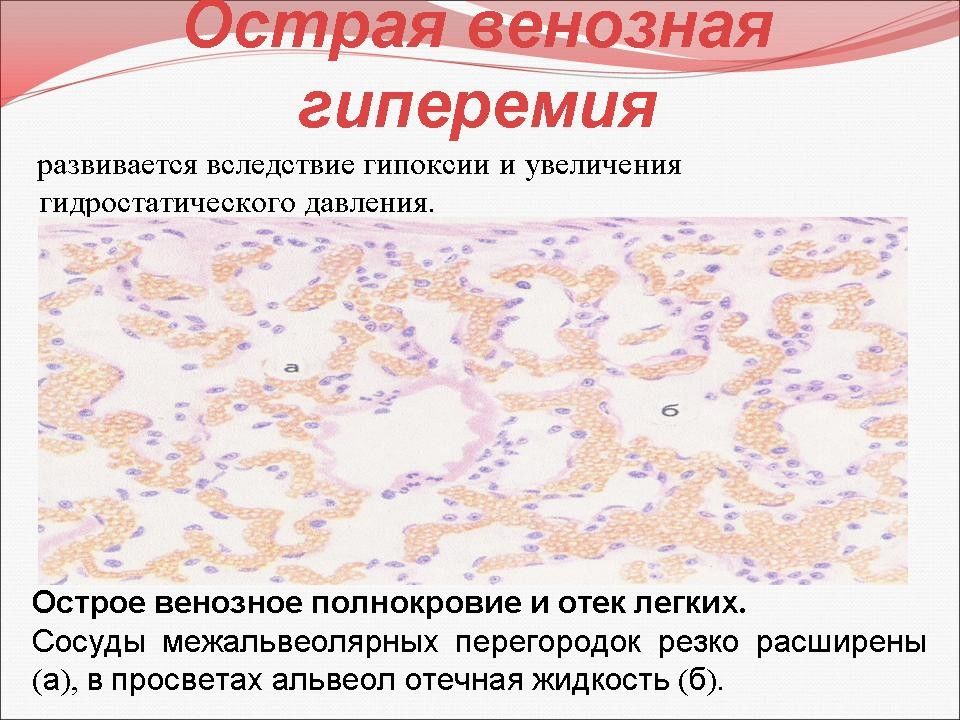 Презентация на тему патология кровообращения и лимфообращения