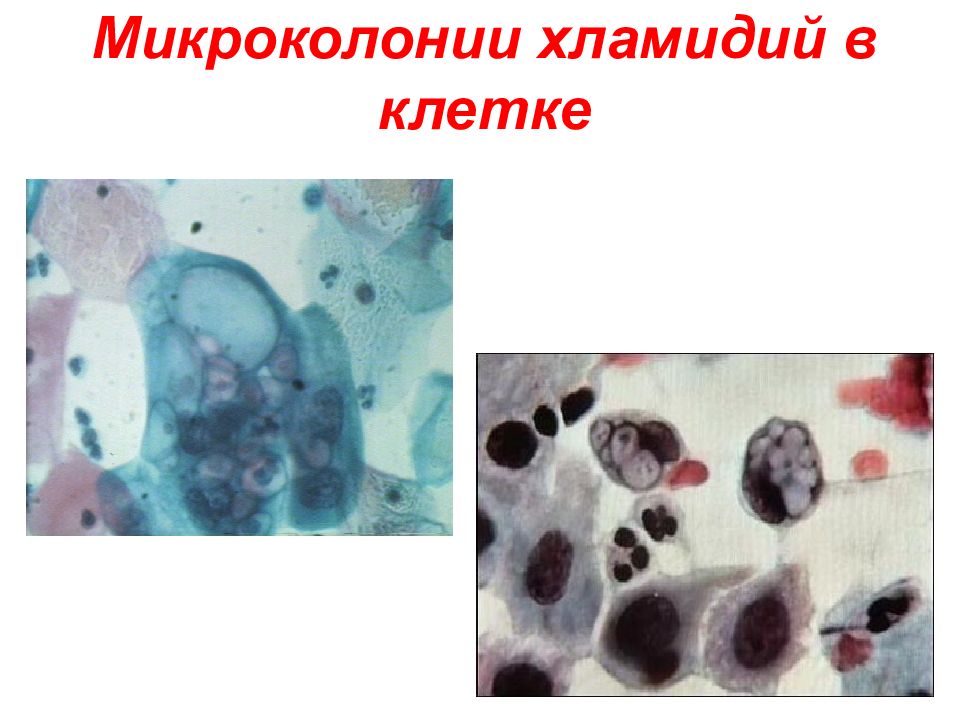 Морфология и физиология микроорганизмов. Chlamydia trachomatis в клетках эпителия. Элементарные тельца хламидий по Романовскому -Гимзе окрашиваются в:.