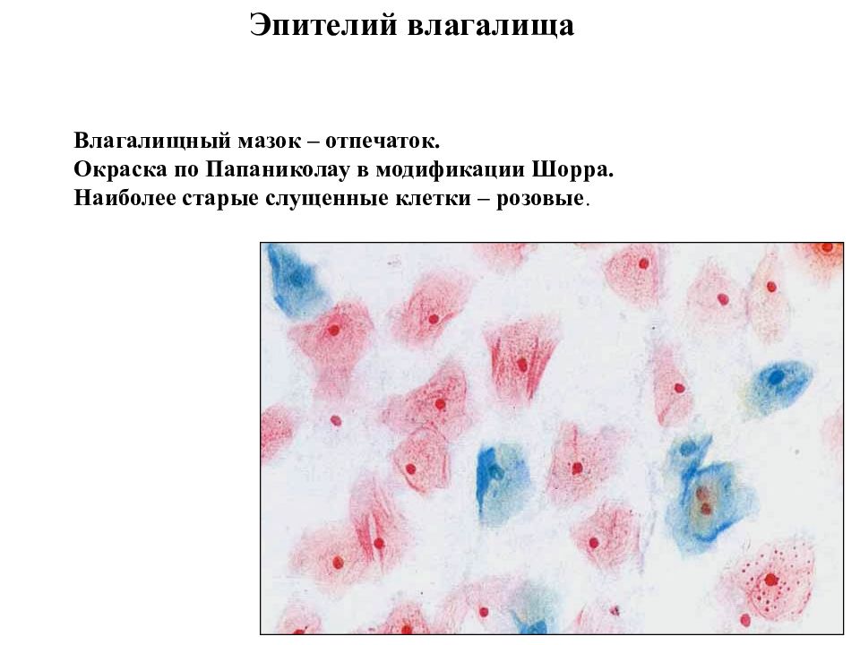 Мазок по папаниколау. Прибор для окраски цитологических мазков по Папаниколау. Клетки влагалищного эпителия.