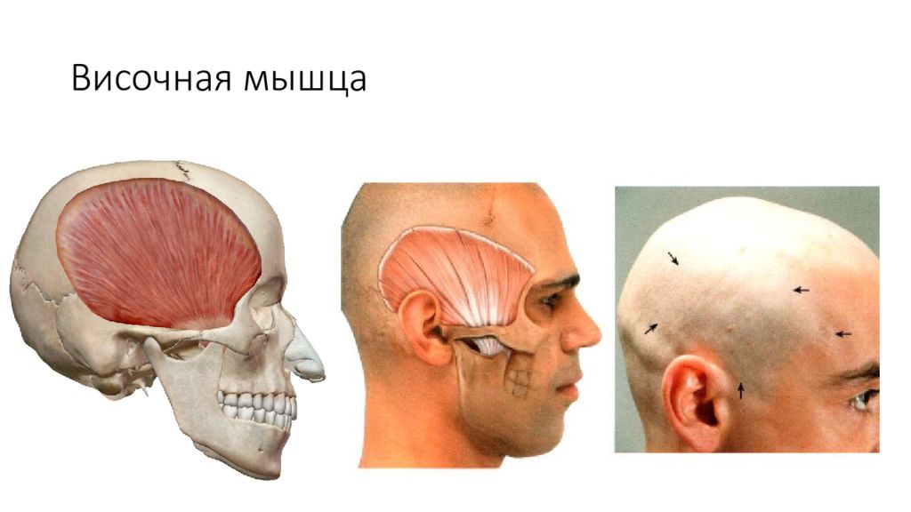 Функция височных мышц. Ход волокон височной мышцы (m. temporalis):. Функция височно теменной мышцы головы. Прикрепление височно теменной мышцы. Височная мышца начало и прикрепление функции.