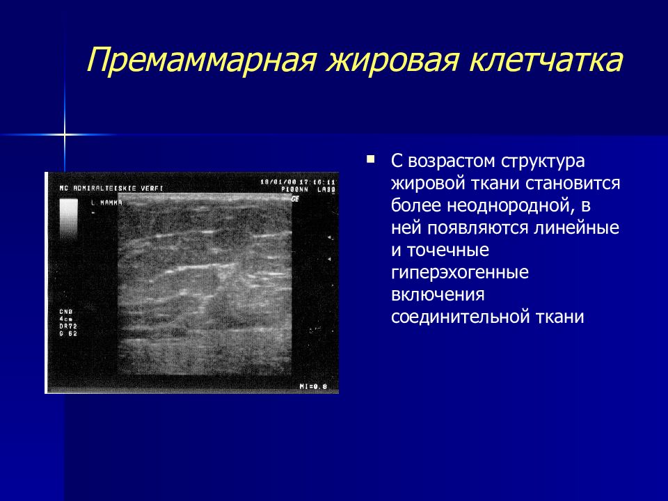 Образование желез. Жировая ткань молочной железы на УЗИ. Премаммарная жировая клетчатка. Гиперэхогенная структура в молочной железе. Парамамарная клетчатка.