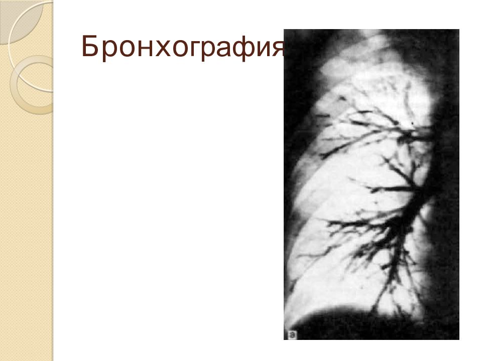 Лучевая диагностика органов дыхания презентация